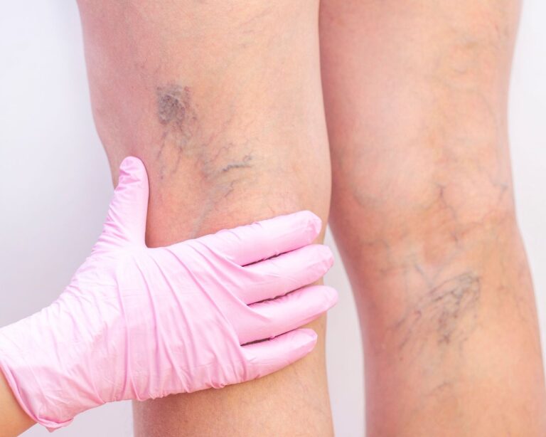 Heute ist Deutscher Venentag!